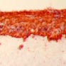Culture de fibroblastes