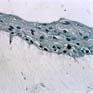 Analyse immunohistochimique