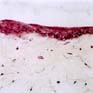 �pith�lium n�o-form�