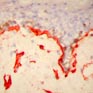 Study based on anti-collagen