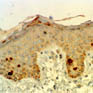 mmunohistochemical analysis