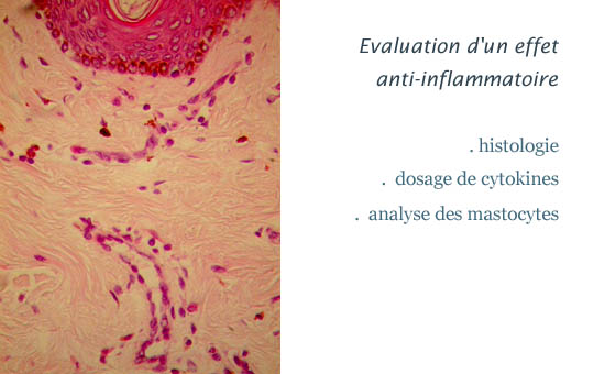 Evaluation d�un effet anti-inflammatoire