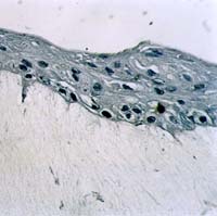 Réalisation d’un équivalent dermique en mélangeant du collagène de type I et des fibroblastes équivalent dermique