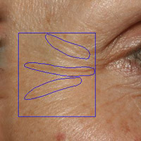 anti-aging effects