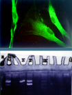 cultures cellulaires : fibroblastes et k�ratinocytes