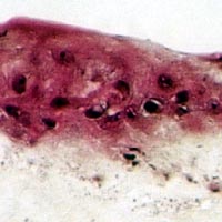 reconstitution in vitro d’équivalents de peau Analyse immunohistochimique