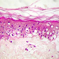 Etude de la réparation cutanée sur un modèle expérimental de brûlure superficielle reparation cutanee