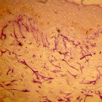 anti-elastasic effect