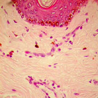 Evaluation of anti-inflammatory effect