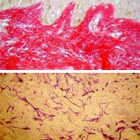 anti-aging mechanism