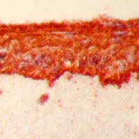cytok�ratine