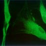 Objectification of the synthesis of collagen from fibroblast