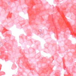 Visualisation des cornéocytes au microscope