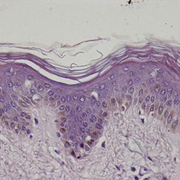 phototrichogrammes