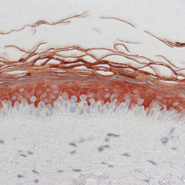 différenciation kératinocyte