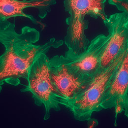 Toxicity of fibroblast or keratinocyte cultures 