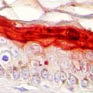 Immunohistochemical analysis