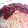 Skin capillaries